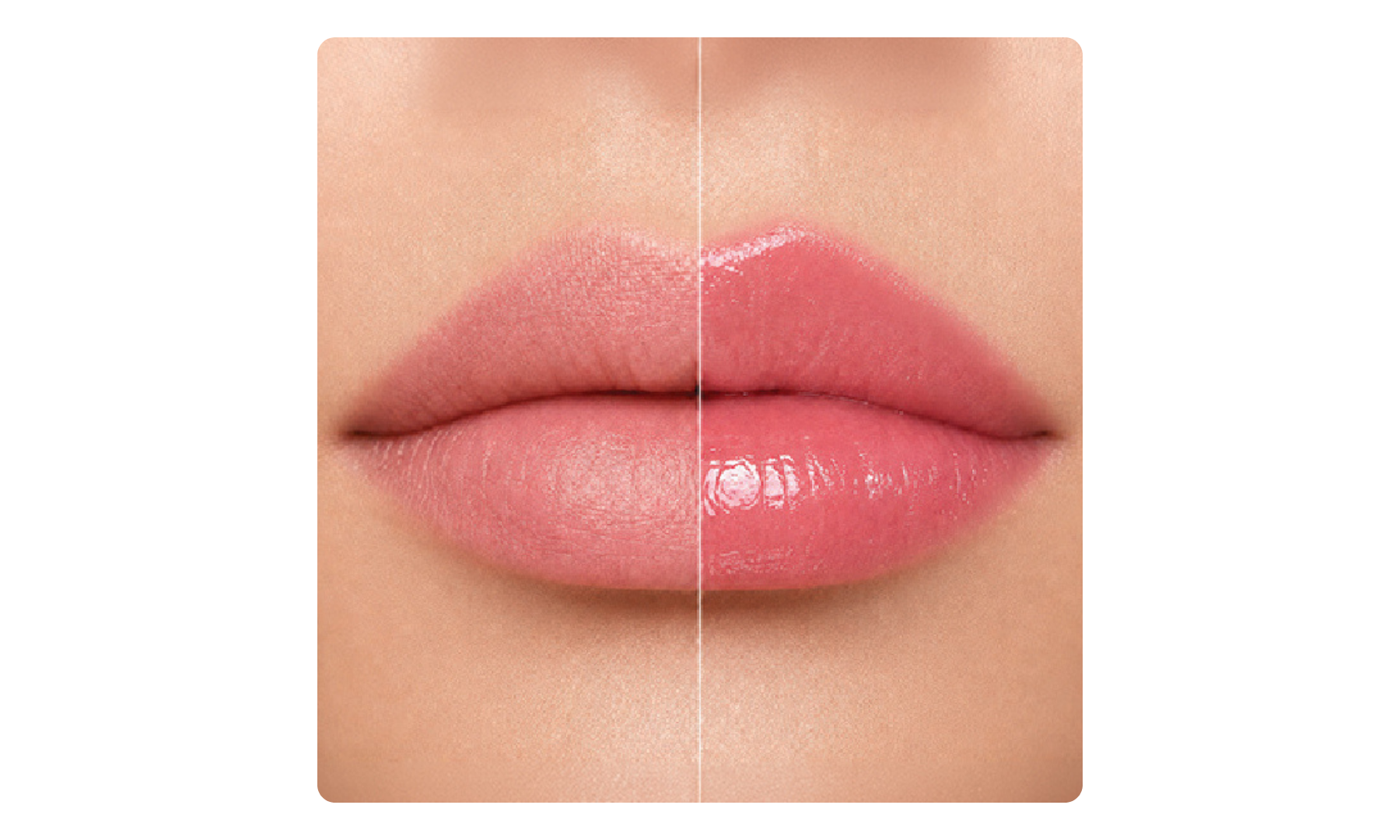 Hyaluronic Lip Balm (2)